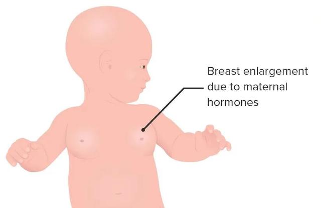 因?yàn)樾靥?，我，被分手? onerror=